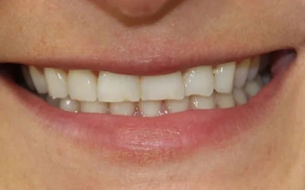 Home Crowns Before 1