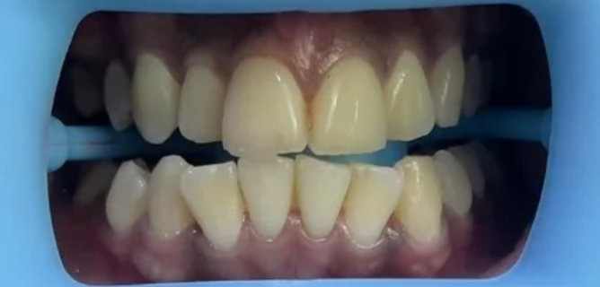 Before and After screenshot 2026 02 03 024356 1